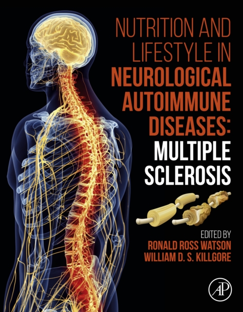 Nutrition and Lifestyle in Neurological Autoimmune Diseases