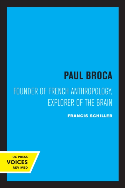Paul Broca