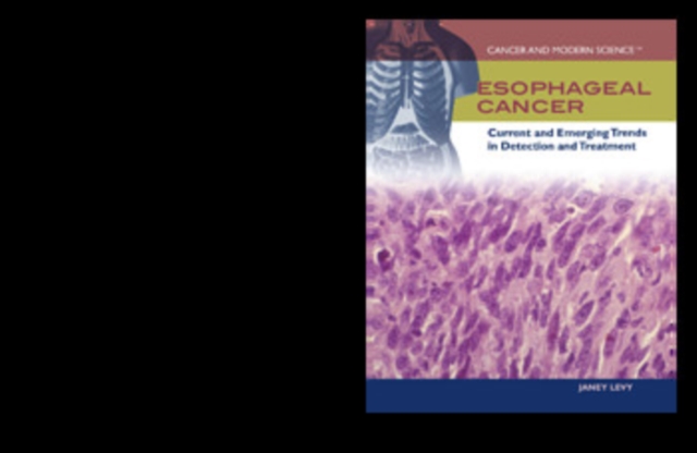 Esophageal Cancer