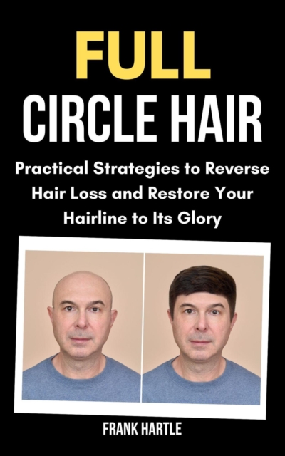 Full Circle Hair: Practical Strategies to Reverse Hair Loss and Restore Your Hairline to Its Glory