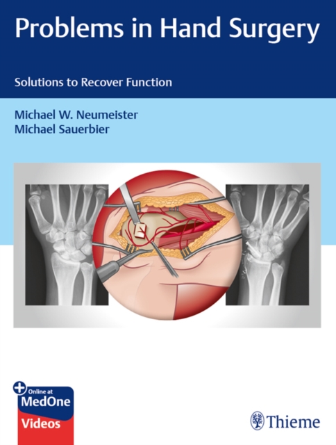 Problems in Hand Surgery