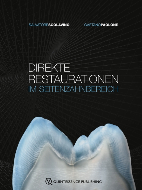 Direkte Restaurationen im Seitenzahnbereich