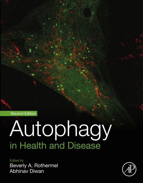Autophagy in Health and Disease