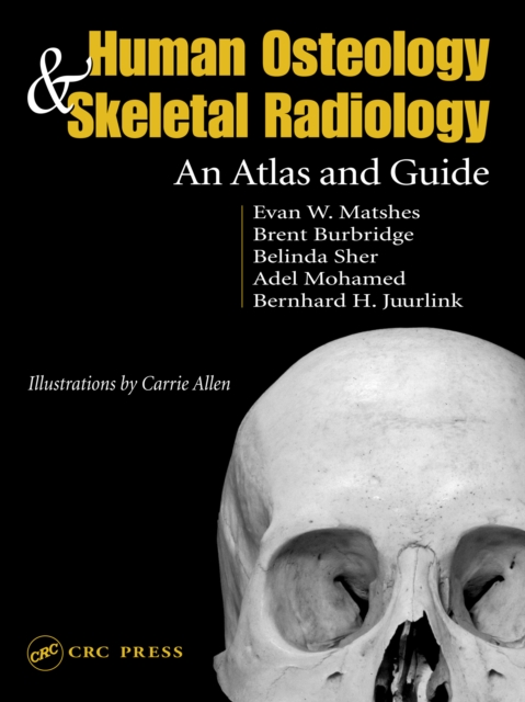 Human Osteology and Skeletal Radiology