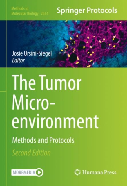 Tumor Microenvironment