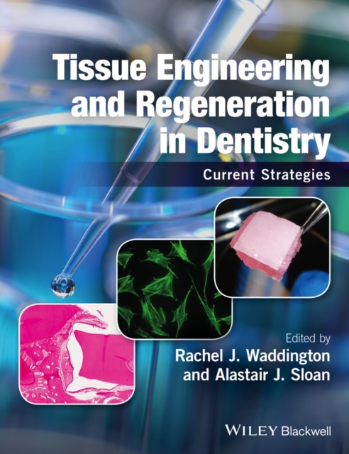 Tissue Engineering and Regeneration in Dentistry