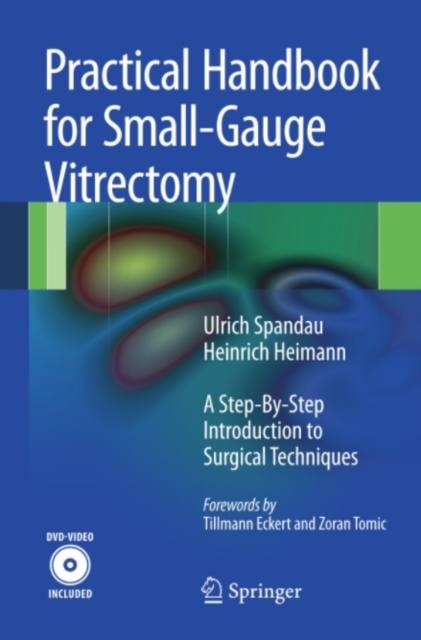 Practical Handbook for Small-Gauge Vitrectomy
