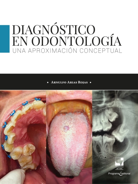 Diagnostico en odontologia. Una aproximacion conceptual