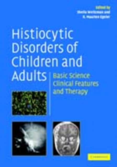Histiocytic Disorders of Children and Adults