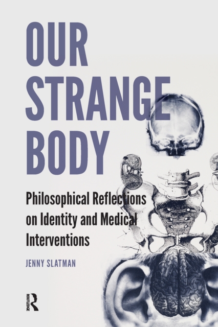Our Strange Body