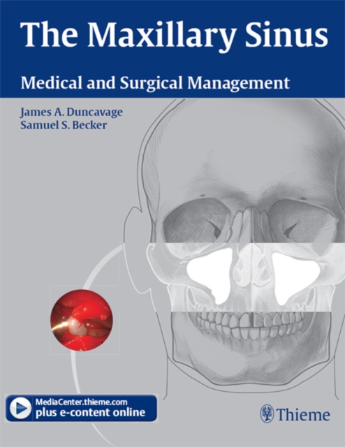 Maxillary Sinus
