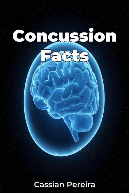 Concussion Facts