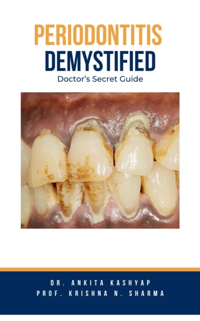 Periodontitis Demystified: Doctor's Secret Guide