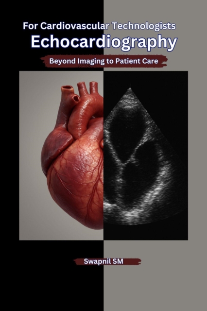 Echocardiography for Cardiovascular Technologists