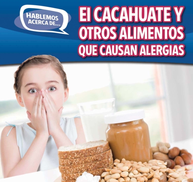El cacahuate y otros alimentos que causan alergias (Peanut and Other Food Allergies)