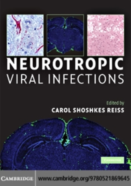 Neurotropic Viral Infections
