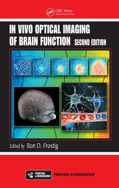 In Vivo Optical Imaging of Brain Function