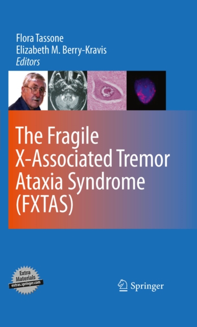 Fragile X-Associated Tremor Ataxia Syndrome (FXTAS)