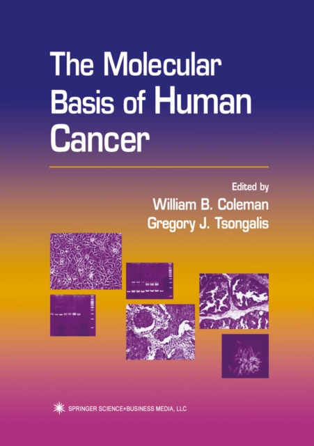 Molecular Basis of Human Cancer