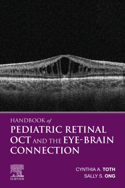 Neurocritical Care, An Issue of Neurosurgery Clinics of North America