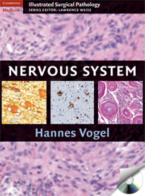 Nervous System