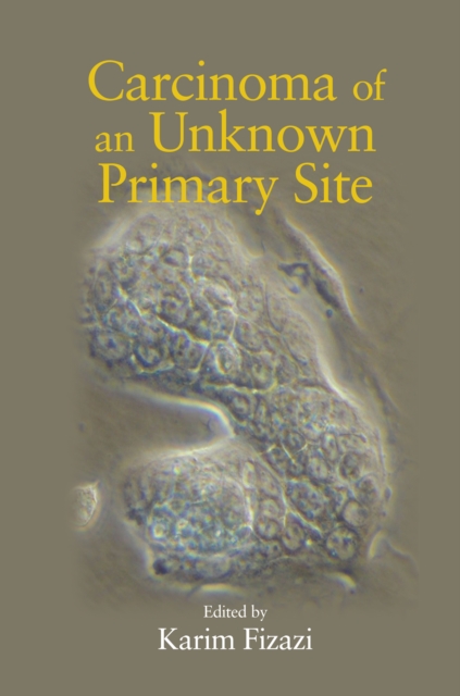 Carcinoma of an Unknown Primary Site