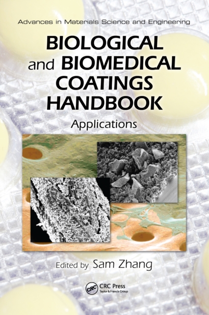 Biological and Biomedical Coatings Handbook