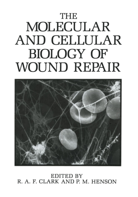 Molecular and Cellular Biology of Wound Repair