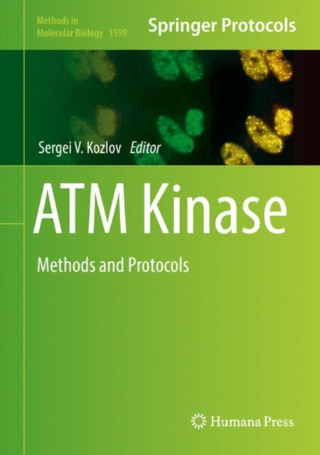 ATM Kinase