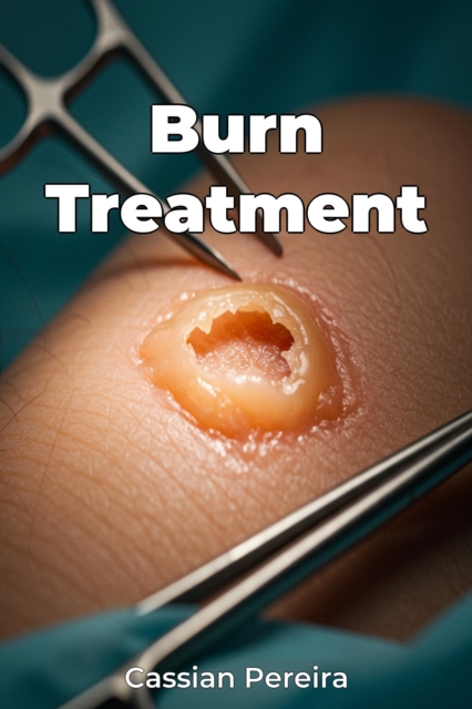 Burn Treatment