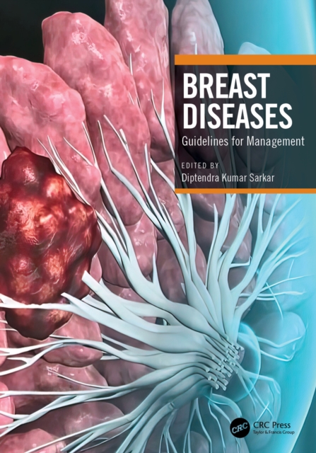 Breast Diseases