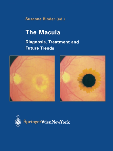 Macula