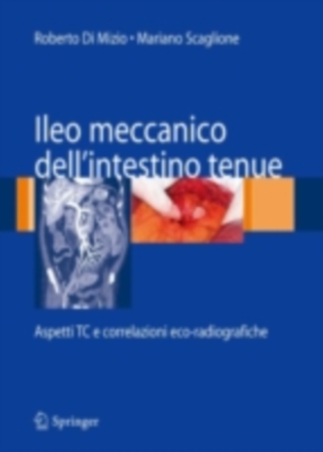 Ileo meccanico dell'intestino tenue