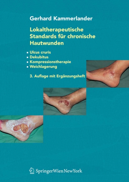 Lokaltherapeutische Standards für chronische Hautwunden