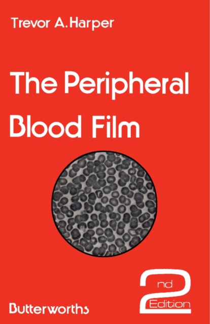 Peripheral Blood Film
