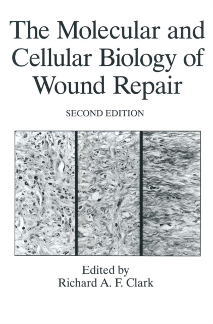 Molecular and Cellular Biology of Wound Repair