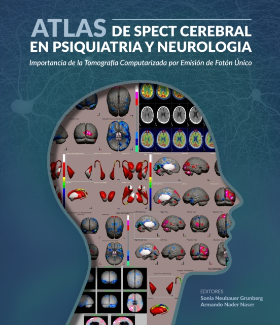Atlas de spect cerebral en psiquiatria y neurologia