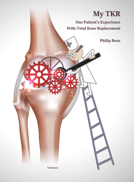 My TKR: One Patient's Experience With Total Knee Replacement