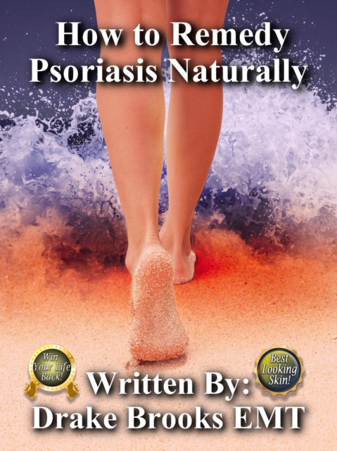 How to Remedy Psoriasis Naturally