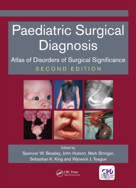 Paediatric Surgical Diagnosis