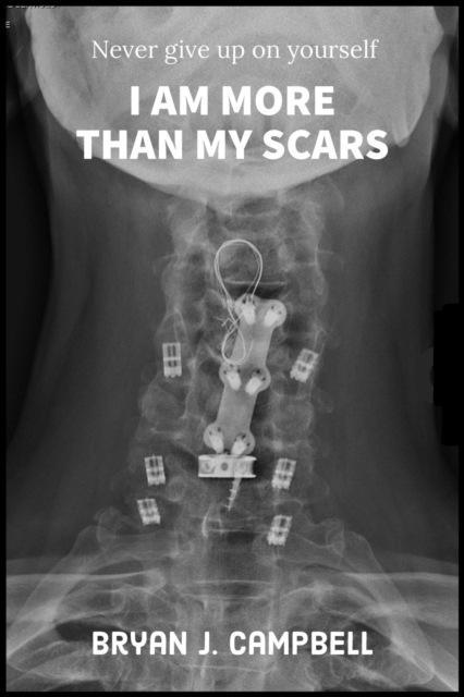 I Am More Than My Scars - Never Give Up On Yourself