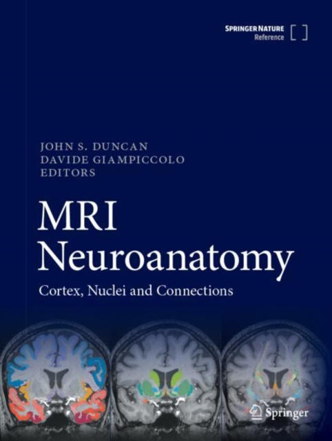 MRI Neuroanatomy