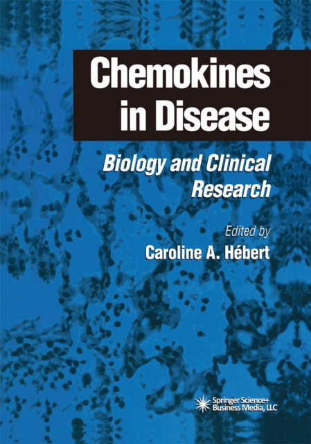 Chemokines in Disease