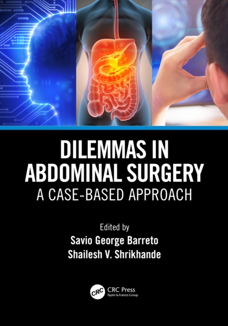 Dilemmas in Abdominal Surgery