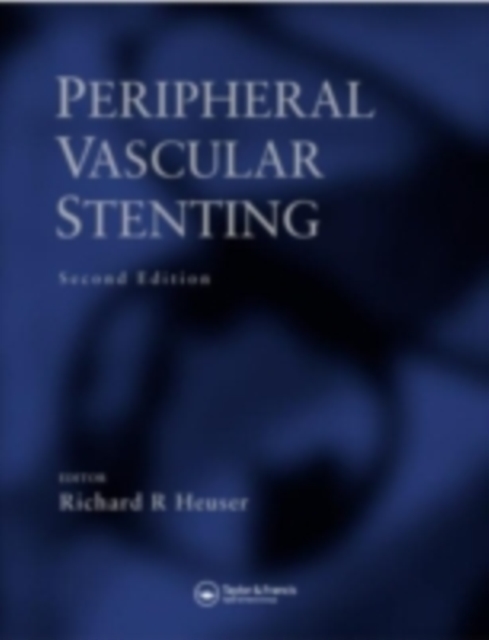 Peripheral Vascular Stenting