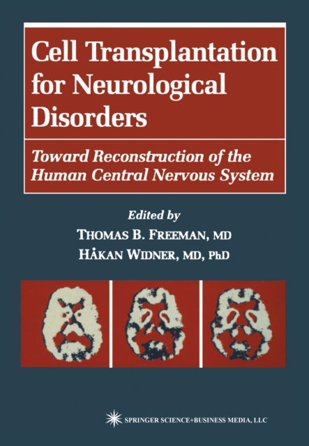 Cell Transplantation for Neurological Disorders