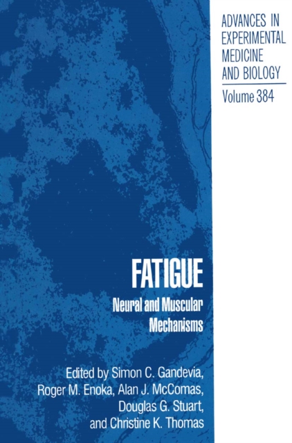 Fatigue