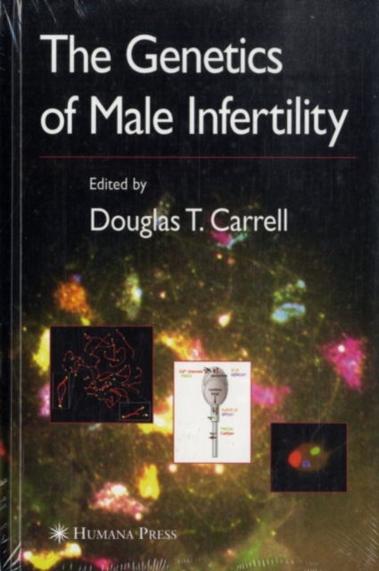 Genetics of Male Infertility