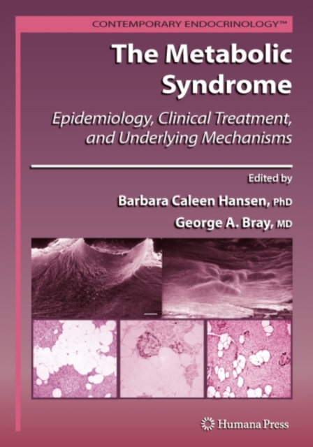 Metabolic Syndrome: