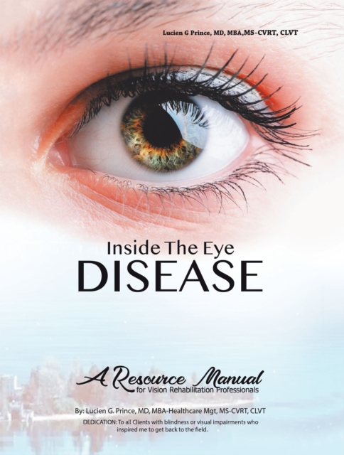 Inside the Eye Disease Just the Facts